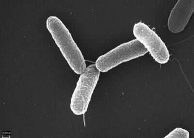 Salmonella Reaches UK Decade High