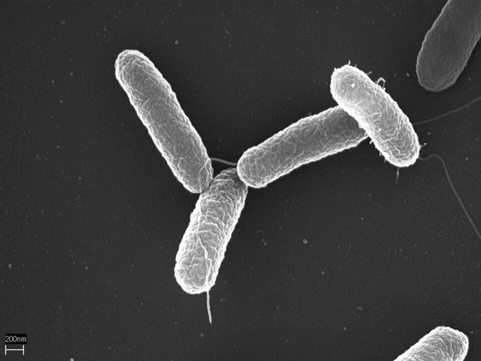 some salmonella cells